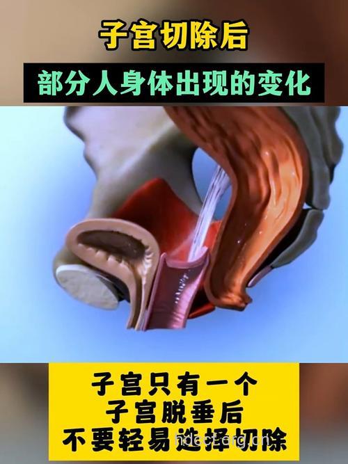 切除子宫后女人身体有哪些变化