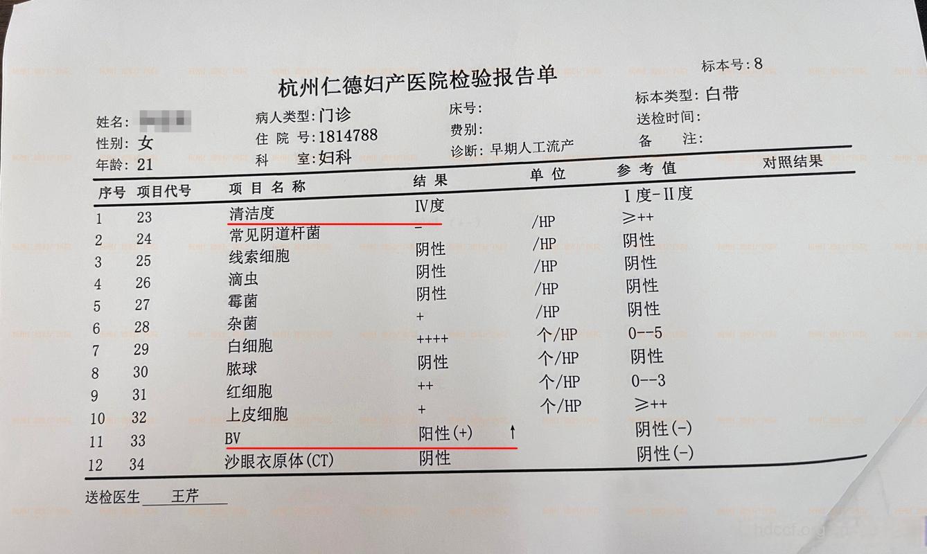 怎么判断白带的化验单