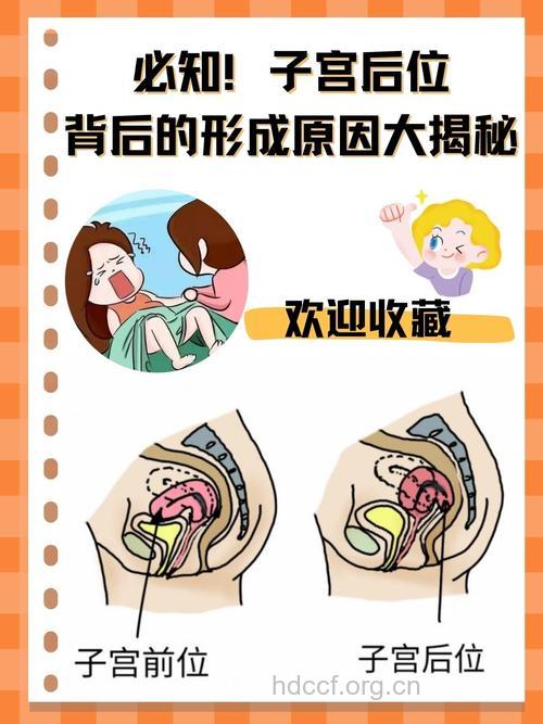 当心！女性仰卧睡觉导致后位子宫