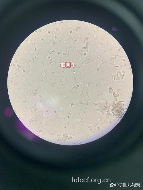 白带检查之实验室检查