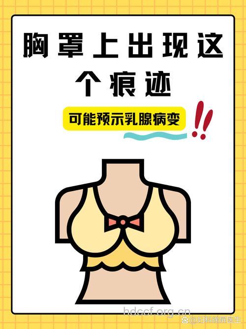 戴文胸睡觉引发乳腺癌？！