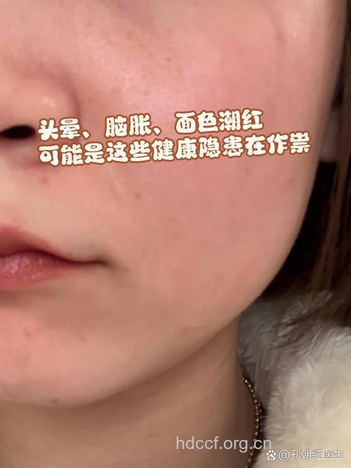 惊悚！脸色红润可能是患病