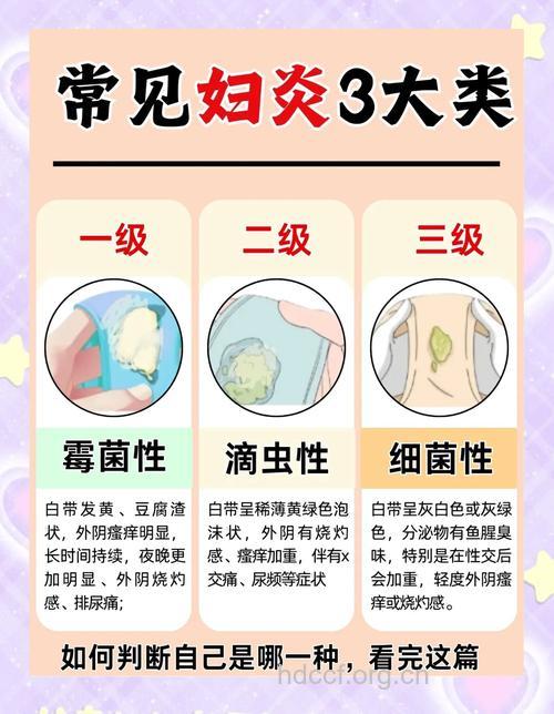 白带异常,不良生活习惯是主因