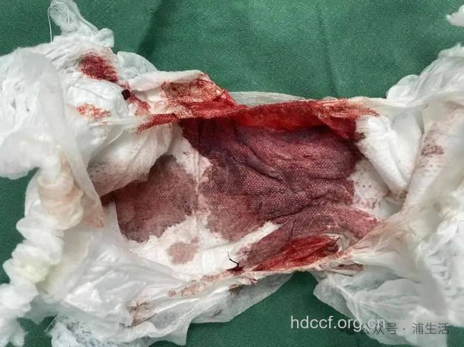 你知道阴道流血的幕后黑手吗?