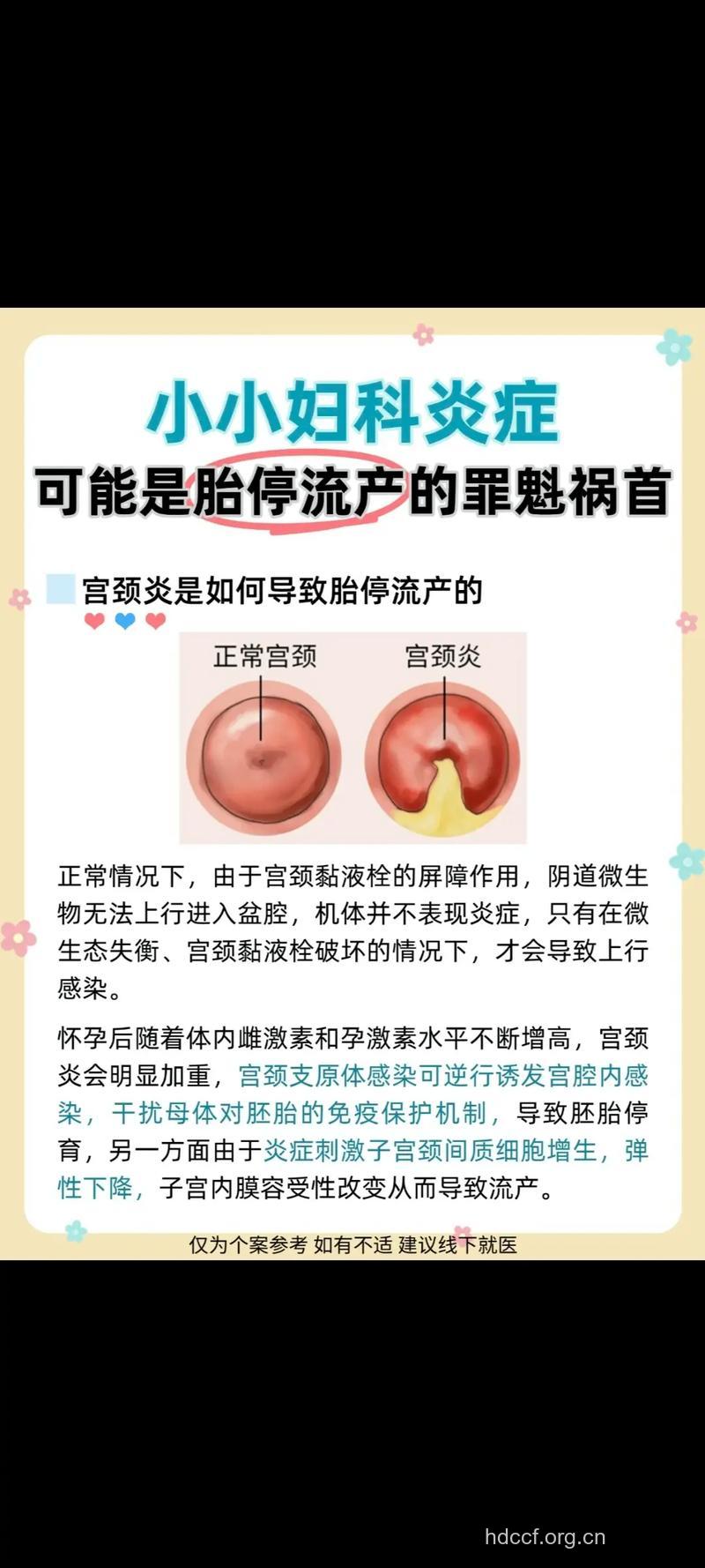 患妇科炎症怀孕有什么危害