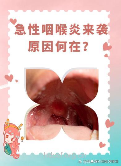 白领为什么易患咽喉炎