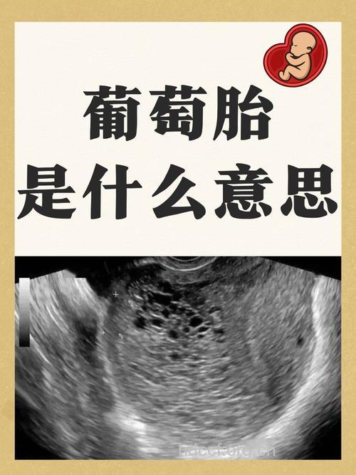 孕妇吃葡萄安胎还是伤胎
