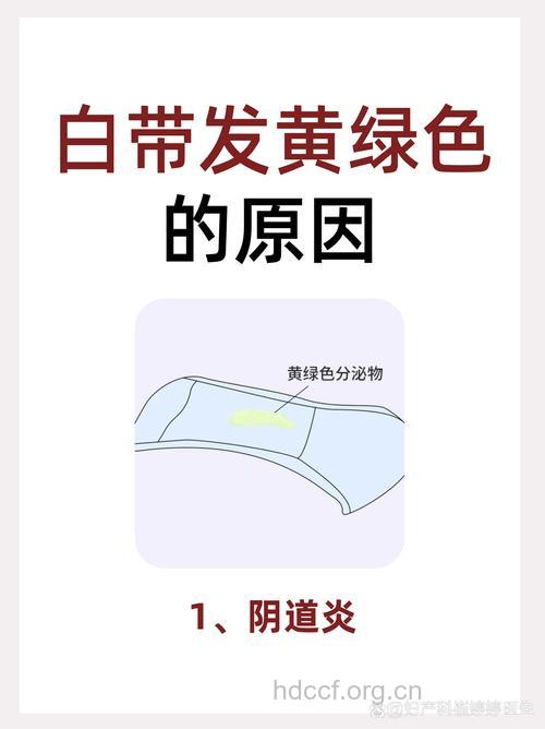 女性警惕白带黄绿