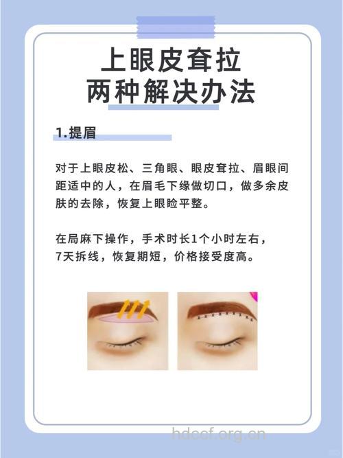 眼部松弛怎么办 几个小方法轻松提拉眼角