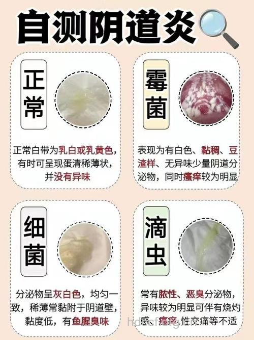 生理性白带和病理性白带有何不同