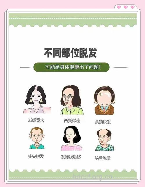 中年女性为什么容易脱发