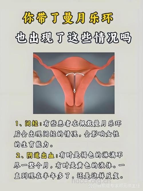 宫颈有炎症可以带环吗