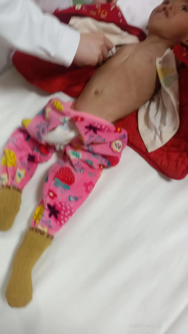 年龄越大越容易生兔唇宝宝
