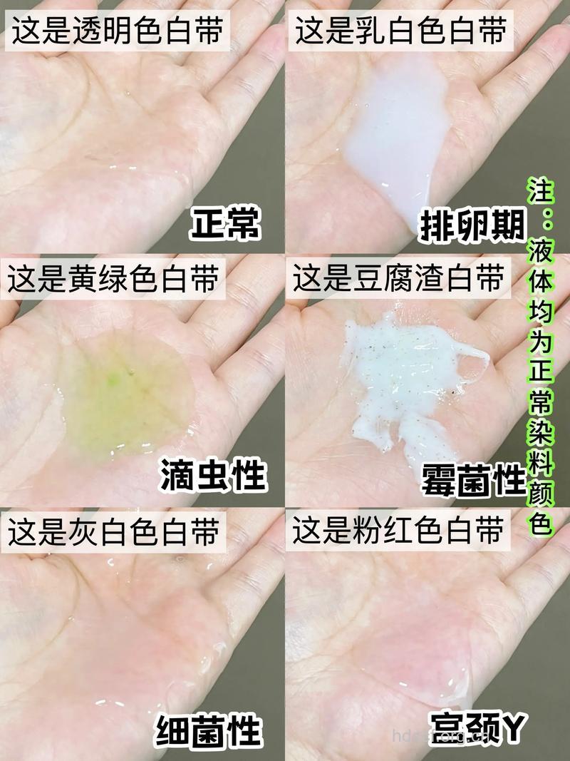 白带多少是正常的