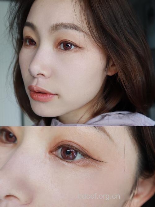 桃色魅力 桃子瘦身美颜祛斑