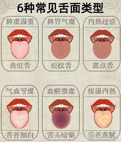 6种舌头的变化透露运势