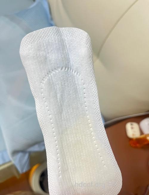 孕妈怀孕期间不宜使用护垫