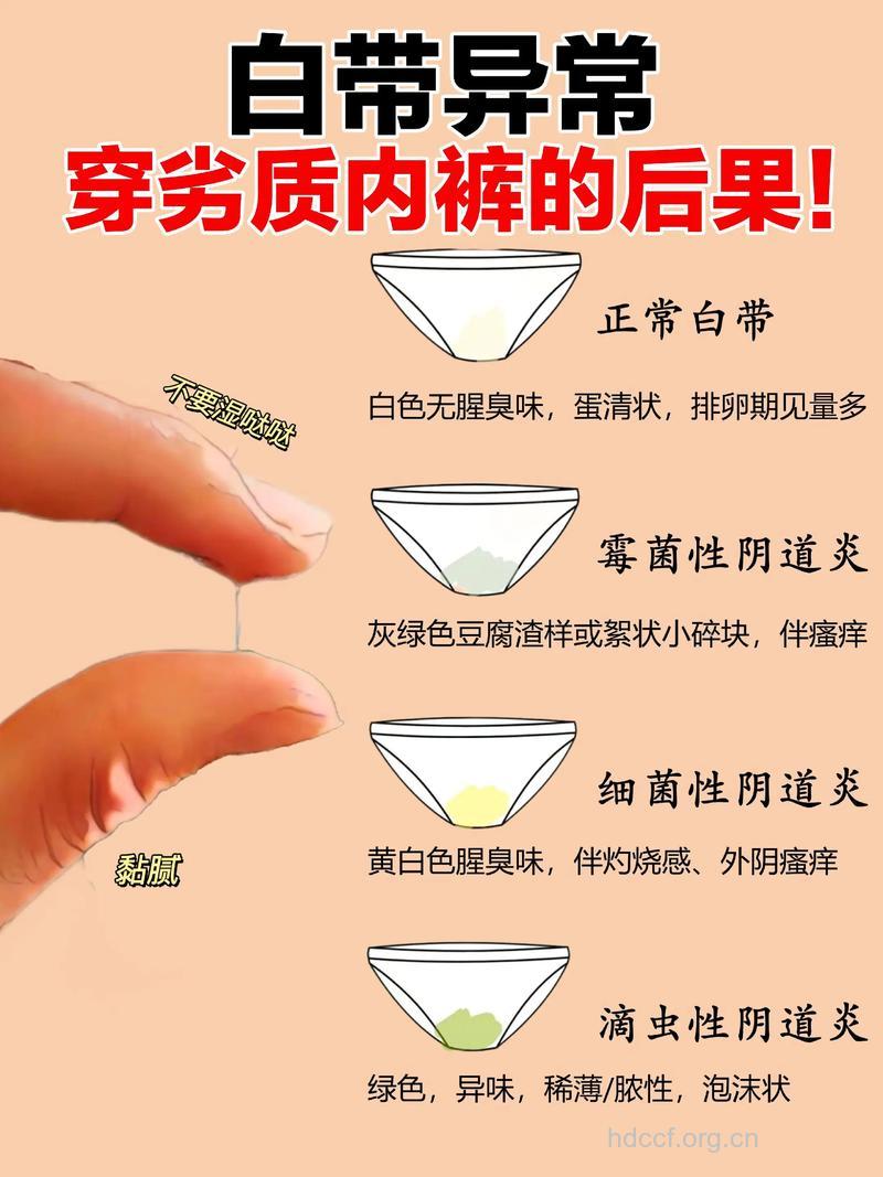 女人警惕三种内裤谋杀健康