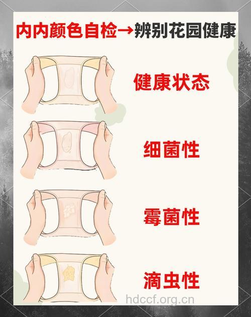 专家：三种内裤危害女性健康