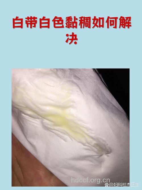 常见的病理性白带有哪些?