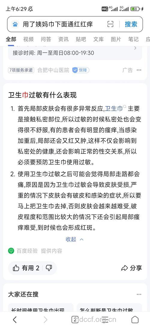 女性如何缓解卫生棉过敏症状？