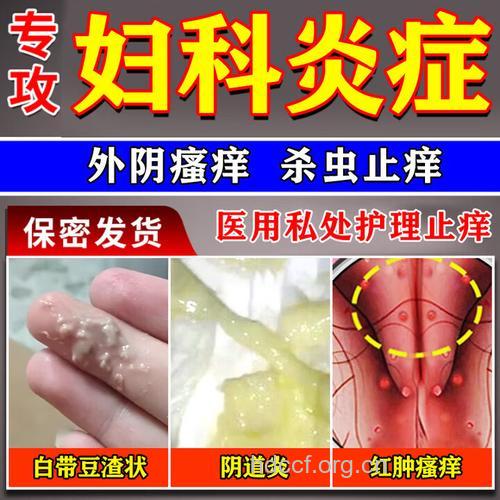 阴道炎患者不要乱用洗液