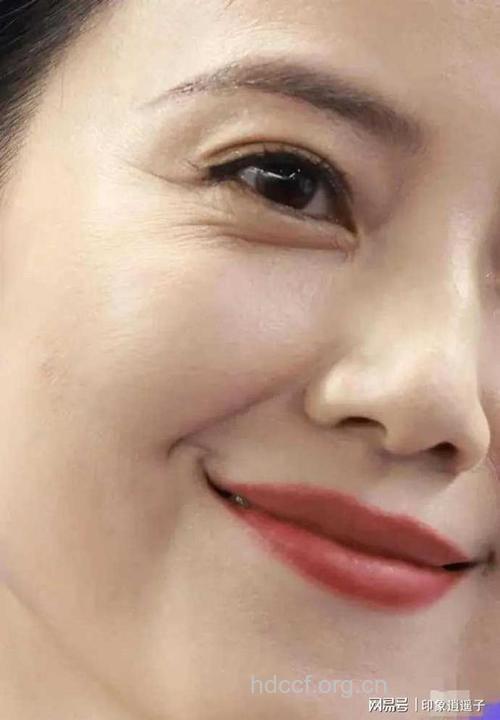 岁月催人老 女人该怎么预防鱼尾纹的产生