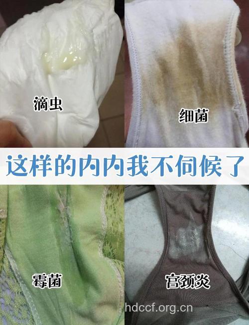 3种内裤会让女性患妇科病