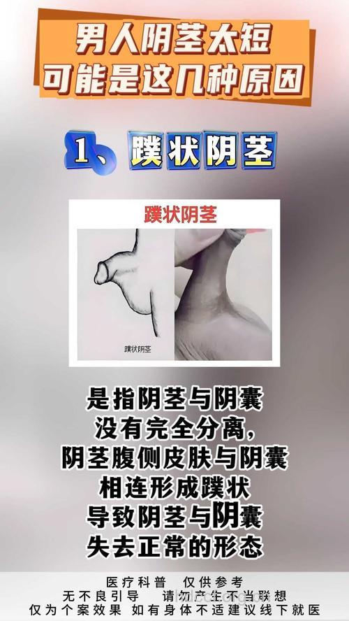 男人最不想被揭的6个短处