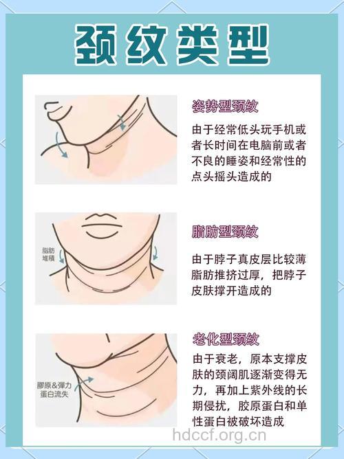 年纪轻轻就有颈纹怎么办 试试这些妙招