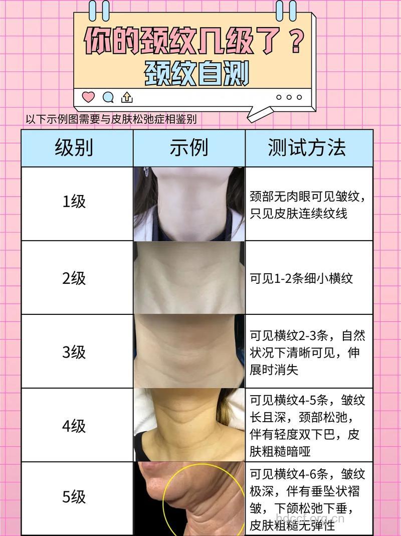 颈纹很深怎么办 赶走颈纹试试这些方法