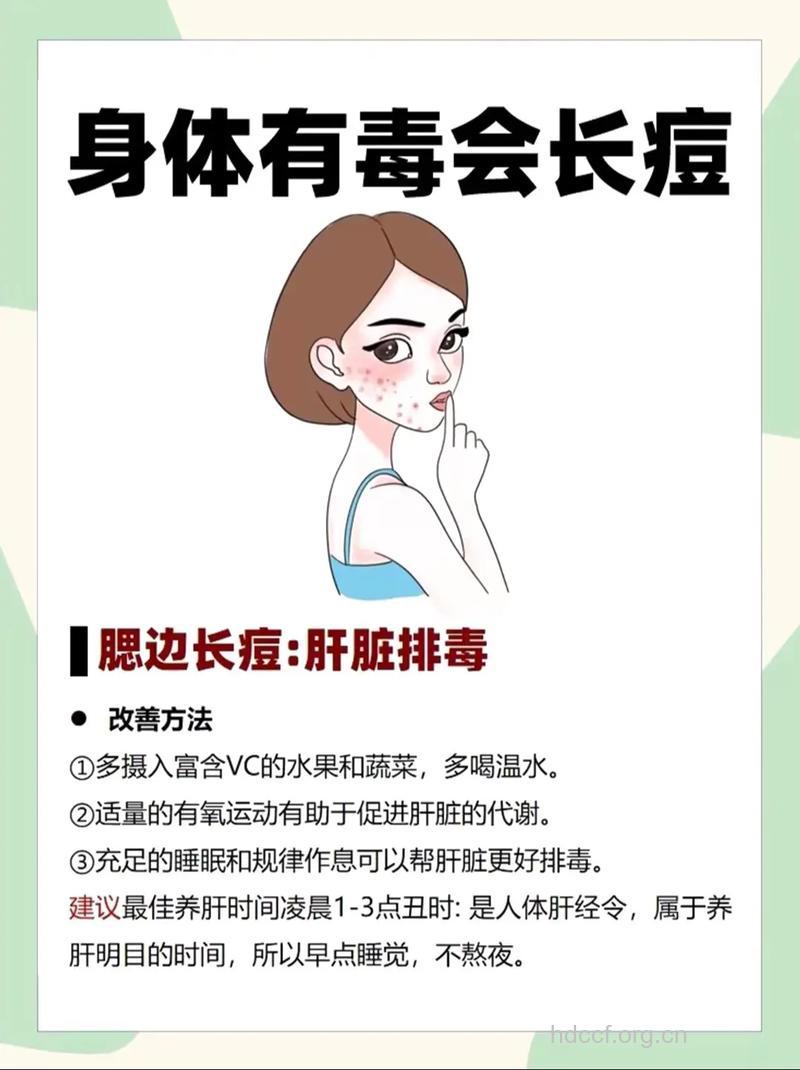 女性长痘是排毒吗 下火祛痘要忌口