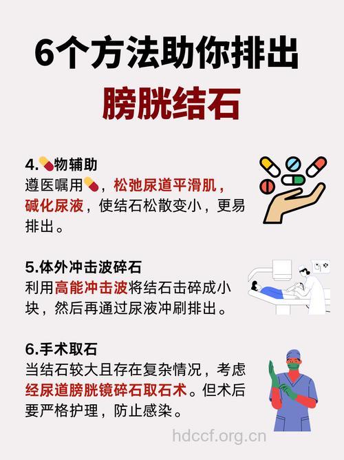 膀胱结石怎么治疗 治疗方法遵循两点原则