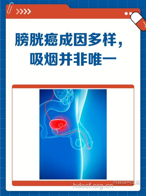 惊!吸烟竟会导致膀胱癌