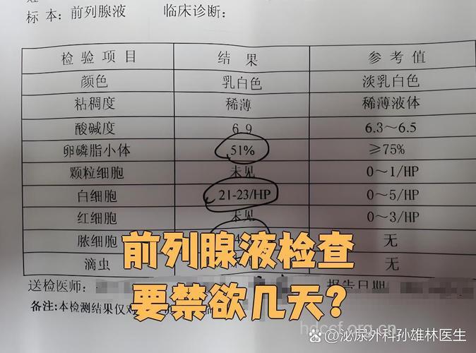 前列腺检查需要禁欲吗 长期禁欲危害大