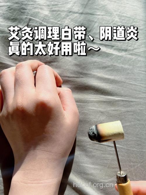 白带异常 女性朋友可用艾灸治病