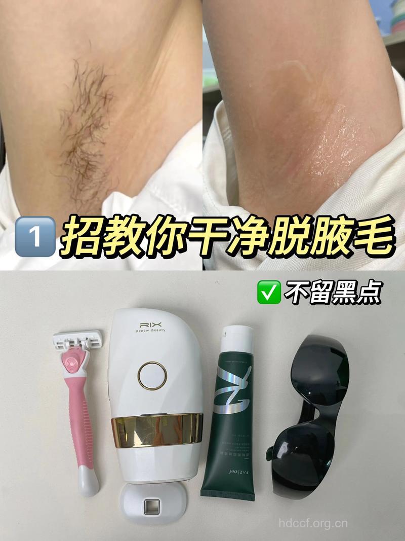 夏天有腋毛不敢穿吊带 8种脱毛的好方法