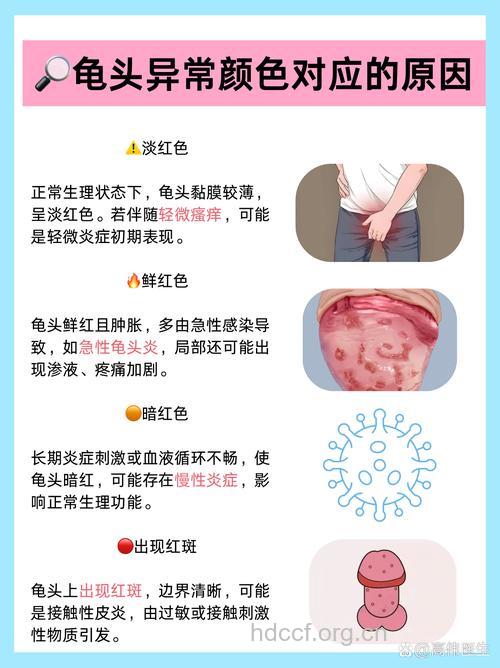 男性龟头发红的原因有哪些