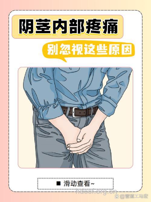 男性阴茎疼痛的原因是什么