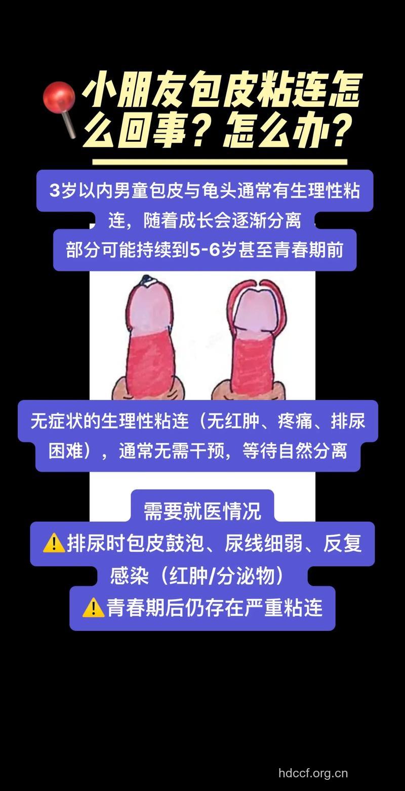 包皮粘连常见危害及治疗方法