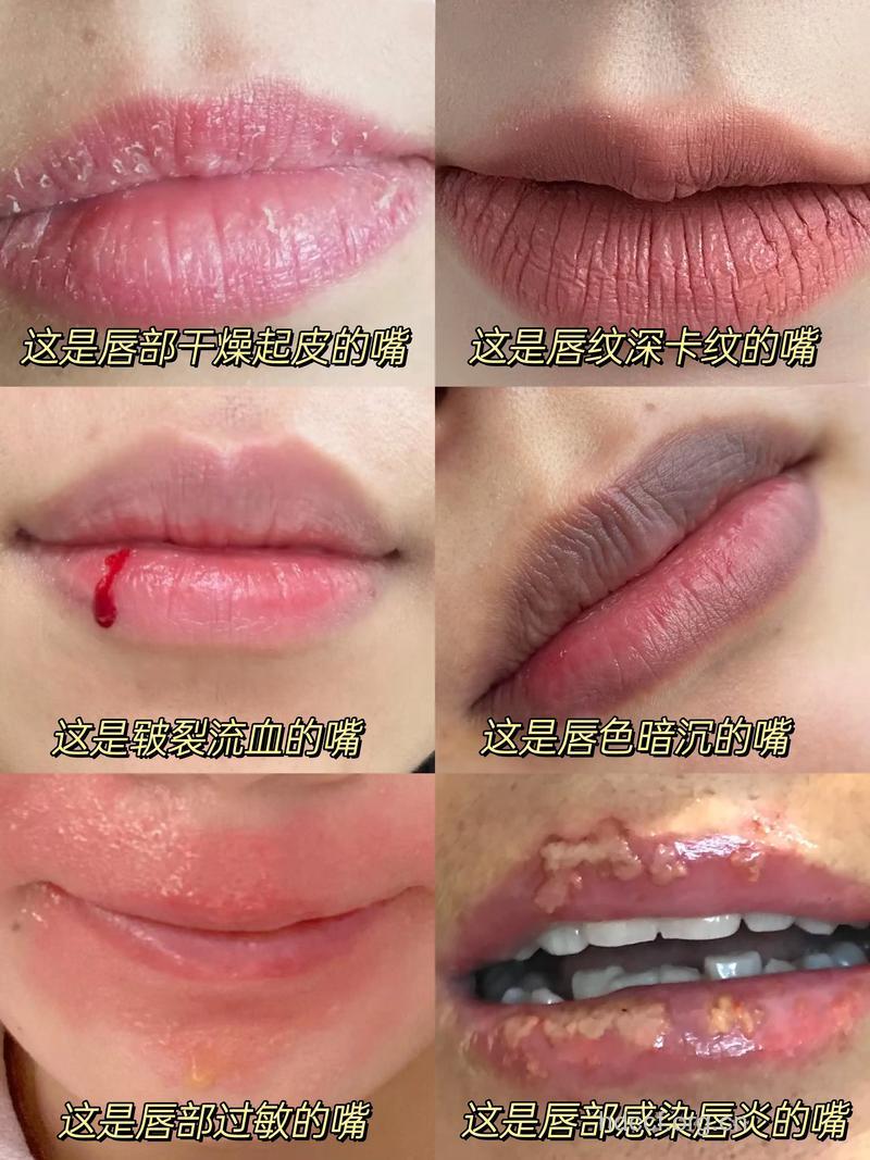 长期涂口红的危害有多大 真相令人咂舌