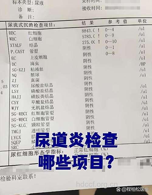男性尿道炎的检查项目