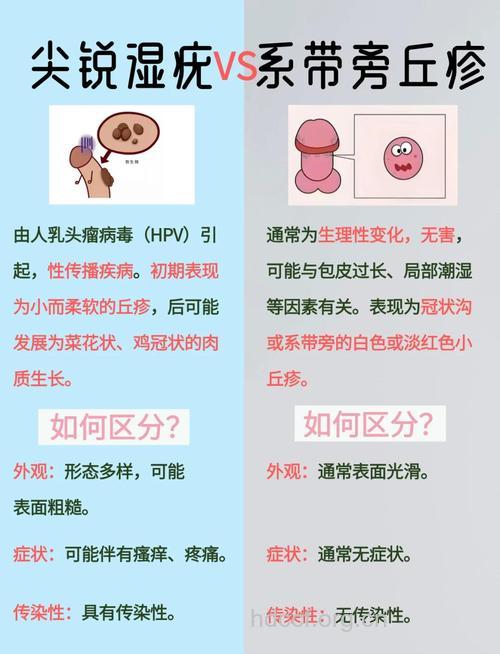 男性常见几种性病类型