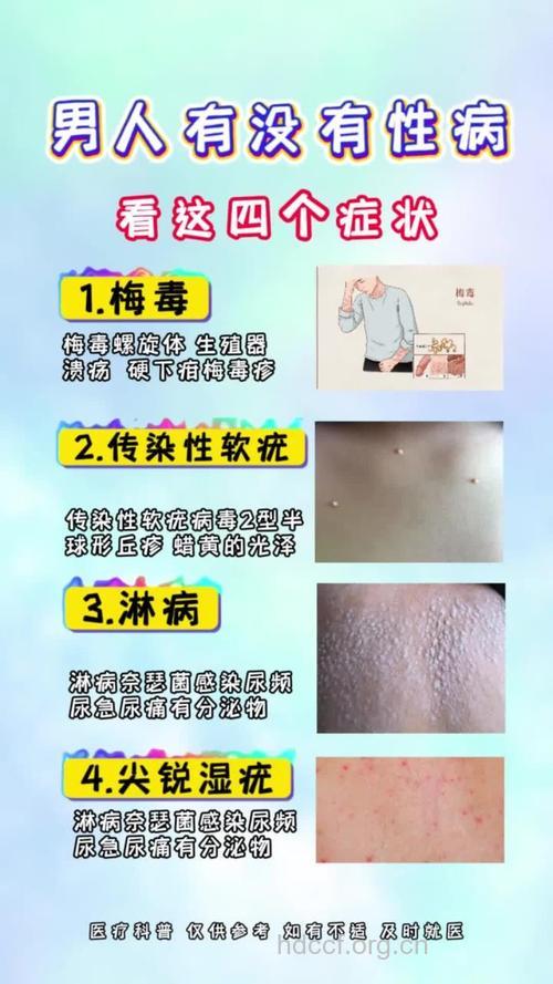 男人最惹不起的4种病