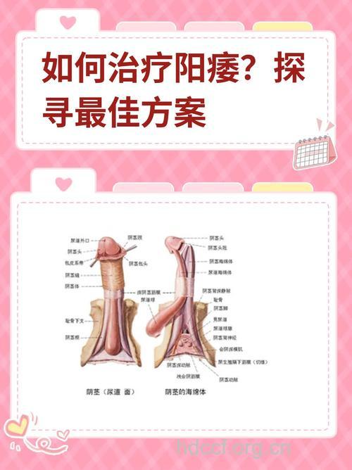 怎么自我治疗阳痿方法
