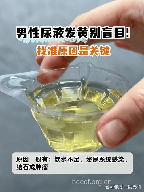 男人尿黄是怎么回事