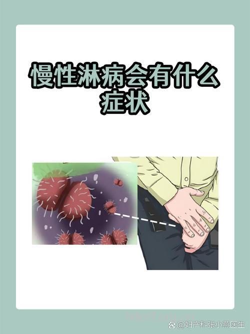 男性慢性淋病临床的表现