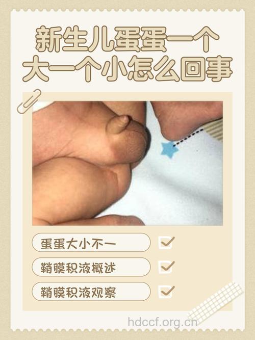 睾丸一个大一个小是怎么回事？
