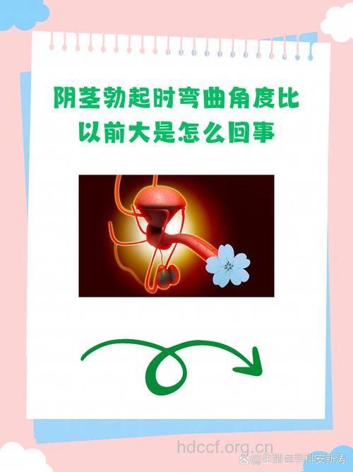 男人小弟弟为何老“抬头”?