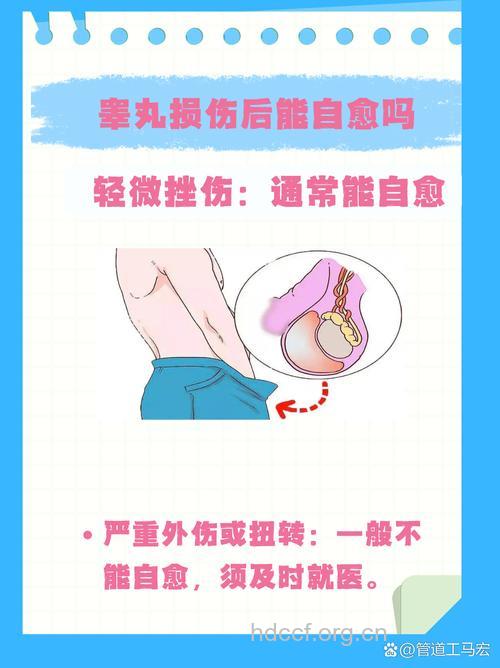 睾丸受伤后应当如何急救？